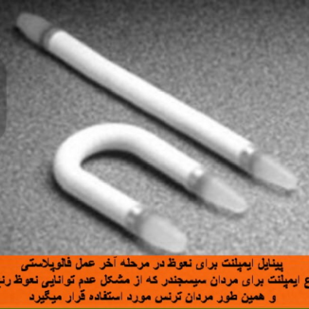 phalloplasty dr afshariyan (12)